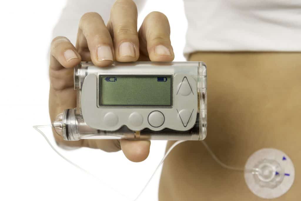 Insulin Pump vs. Injections