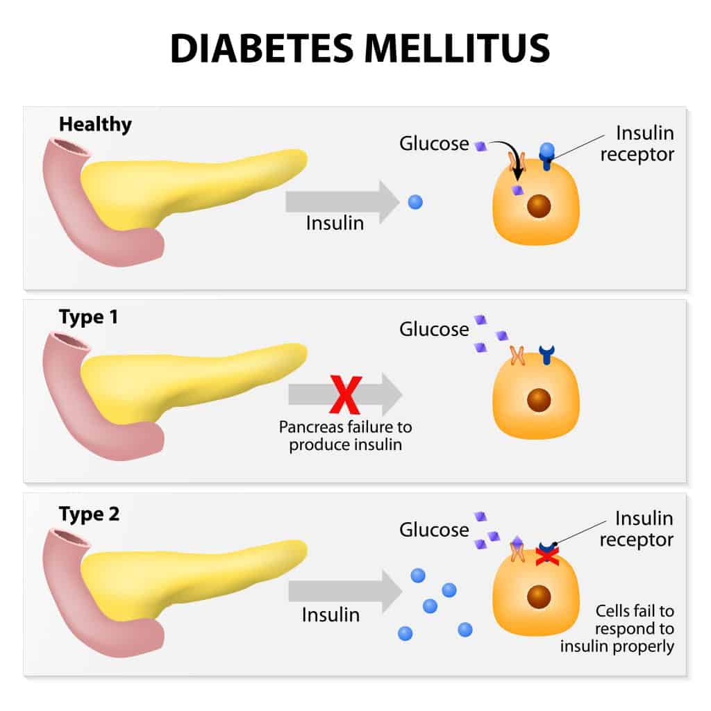 Does the Pancreas Produce Insulin